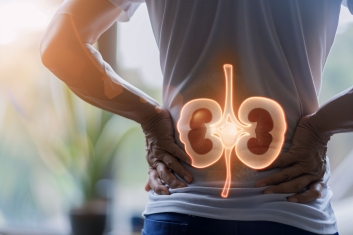 High-Risk Factors for Developing Kidney Stones and How to Avoid Them