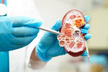 Renal Artery Stenting: A Solution for Renal Artery Stenosis