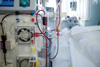Advanced Dialysis for Patients with Liver Failure and Hepato-Renal Syndrome